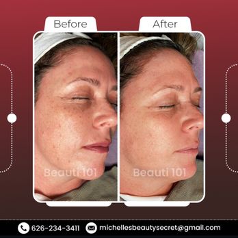 Beauti 101 - Skin Care Near Me - South Pasadena, California Beauti 101 - Skin Care Near Me - South Pasadena, California