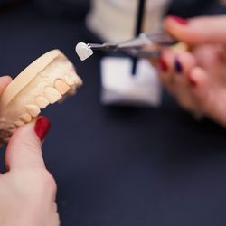 Dentim Clinic - Ultracienkie licówki, które nie wymagają szlifowania, SoftVeneers w Dentim Clinic. www.dentim.pl