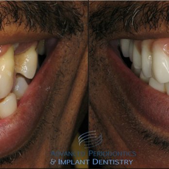Richard Nejat, DDS - Periodontists Near Me - New York, New York Richard Nejat, DDS - Periodontists Near Me - New York, New York