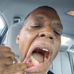 Dental Dreams - More damage!