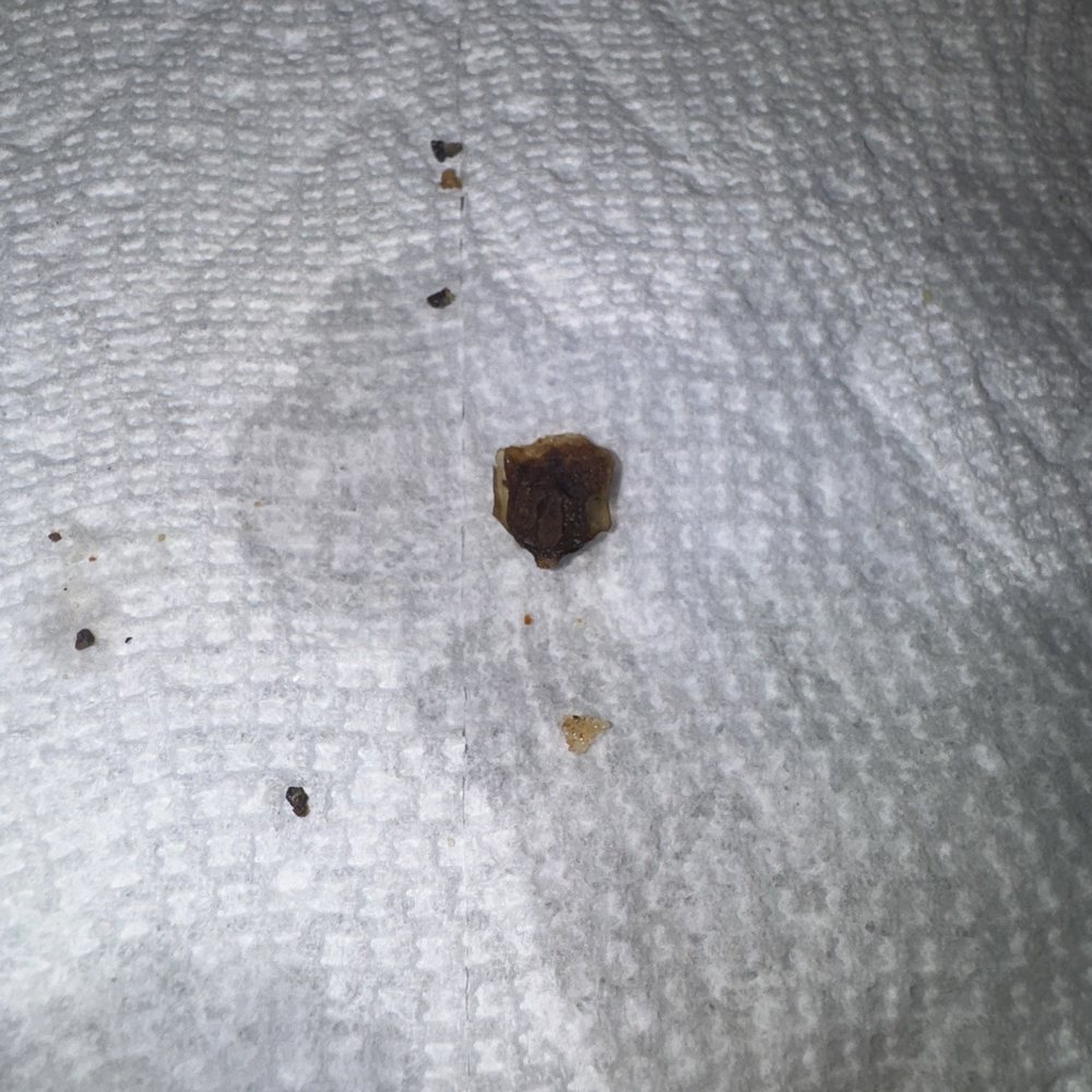 Wingstop - Dead roach. - Chicken Wings Near Me - Fontana, California Wingstop - Dead roach. - Chicken Wings Near Me - Fontana, California