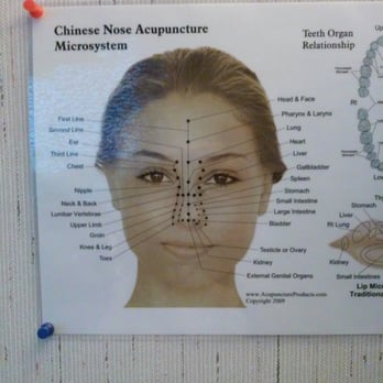 Steven Chasens - Acupuncture of the nose. Who knew! - Acupuncture Near Me - Miami, Florida