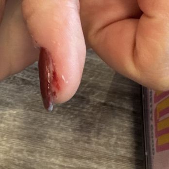 Artisan Nails Lash And Brow - Thumb filed raw to the point of bleeding - Nail Salons Near Me - Fort Collins, Colorado