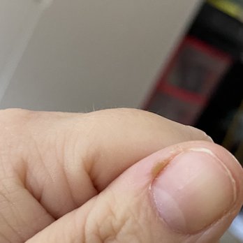 Ele Ela Nail Salon - Nail infection from too close of cuticle cutting.. beware!! - Nail Salons Near Me - Pacifica, California Ele Ela Nail Salon - Nail infection from too close of cuticle cutting.. beware!! - Nail Salons Near Me - Pacifica, California