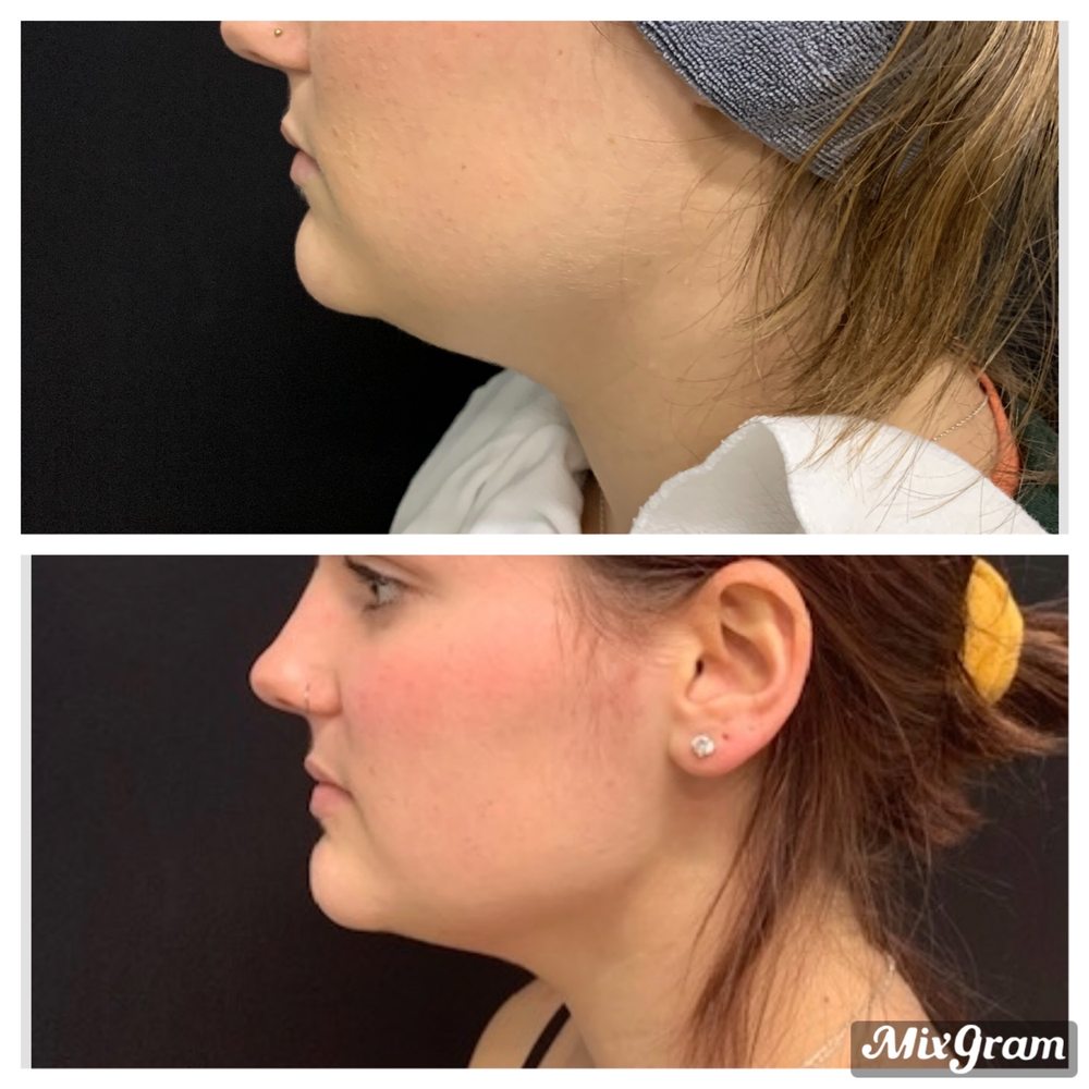 SHARPER PLASTIC & RECONSTRUCTIVE SURGERY Updated August 2024 10