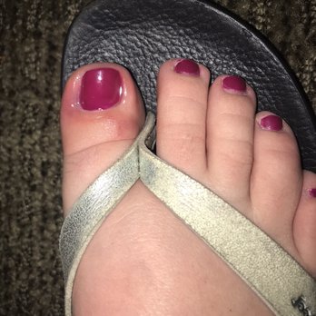 Annie Nails & Spa - Toe infection from the salon. - Nail Salons Near Me - Whittier, California Annie Nails & Spa - Toe infection from the salon. - Nail Salons Near Me - Whittier, California