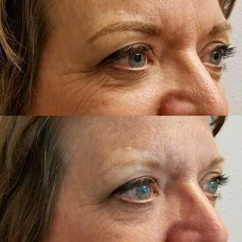 On Point Permanent Makeup - Permanent Makeup Near Me - Temecula, California