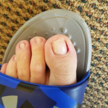 NailPro - Cut up big toe and evidence of failure to remove old clear coat. - Nail Salons Near Me - Virginia Beach, Virginia NailPro - Cut up big toe and evidence of failure to remove old clear coat. - Nail Salons Near Me - Virginia Beach, Virginia