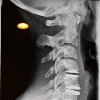 Simply In Demand Chiropractic - Chiropractors Near Me - New River, Arizona