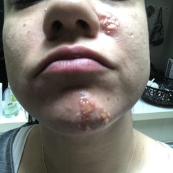 Laser Clinics Australia - Melbourne Emporium - LCA - QV Melbourne
