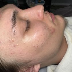 Mila Beauty - Before facial cleansing