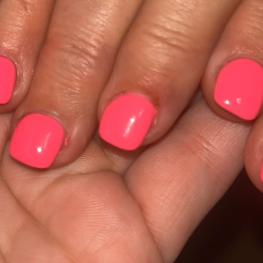 Cut/burned cuticle Cut/burned cuticle
