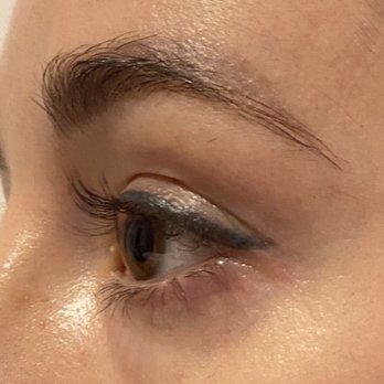 Shannon Lee Esthetics - Before - Skin Care Near Me - New York, New York