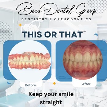 Boca Dental Group - Orthodontic treatment before and after! - General Dentistry Near Me - Boca Raton, Florida