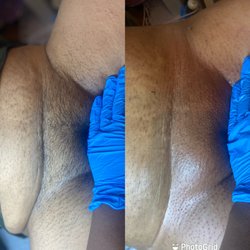 Skyntimate Beauty - Before and after Brazilian wax