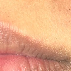Mehak Beauty Parlor - The burn she left on my face.