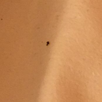 Ibis Amsterdam Centre Hotel - Mattress pad with bugs under my sheets - Hotels Near Me - Amsterdam, New Hampshire Ibis Amsterdam Centre Hotel - Mattress pad with bugs under my sheets - Hotels Near Me - Amsterdam, New Hampshire
