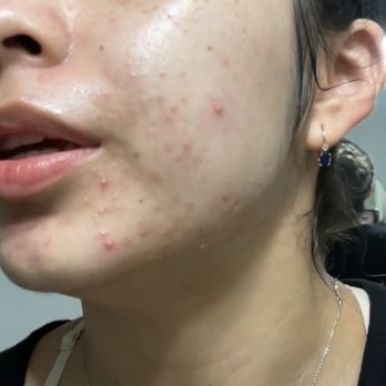Thrēo Skin - Skin Care Near Me