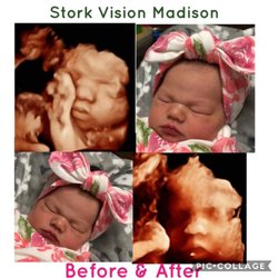 Stork Vision Madison - Our very FIRST Before & After since our new management & staff took over Oct 1, 2018.