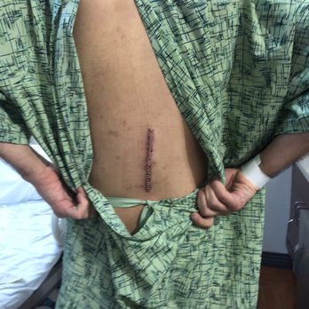 Alexander Taghva, MD - Spine Surgeons Near Me - Mission Viejo, California