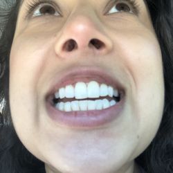 Plano Gentle Dental - No filter! Best cleaning and service! Dr Monica Jain is amazing