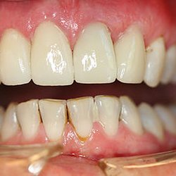 Covenant Family Dental Care