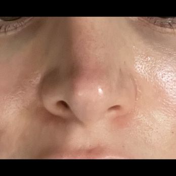 Jay Calvert, MD - Cosmetic Surgeons Near Me - Beverly Hills, California