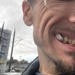 MLK Community Dental & Denture - See it's out yeaaaaayy!