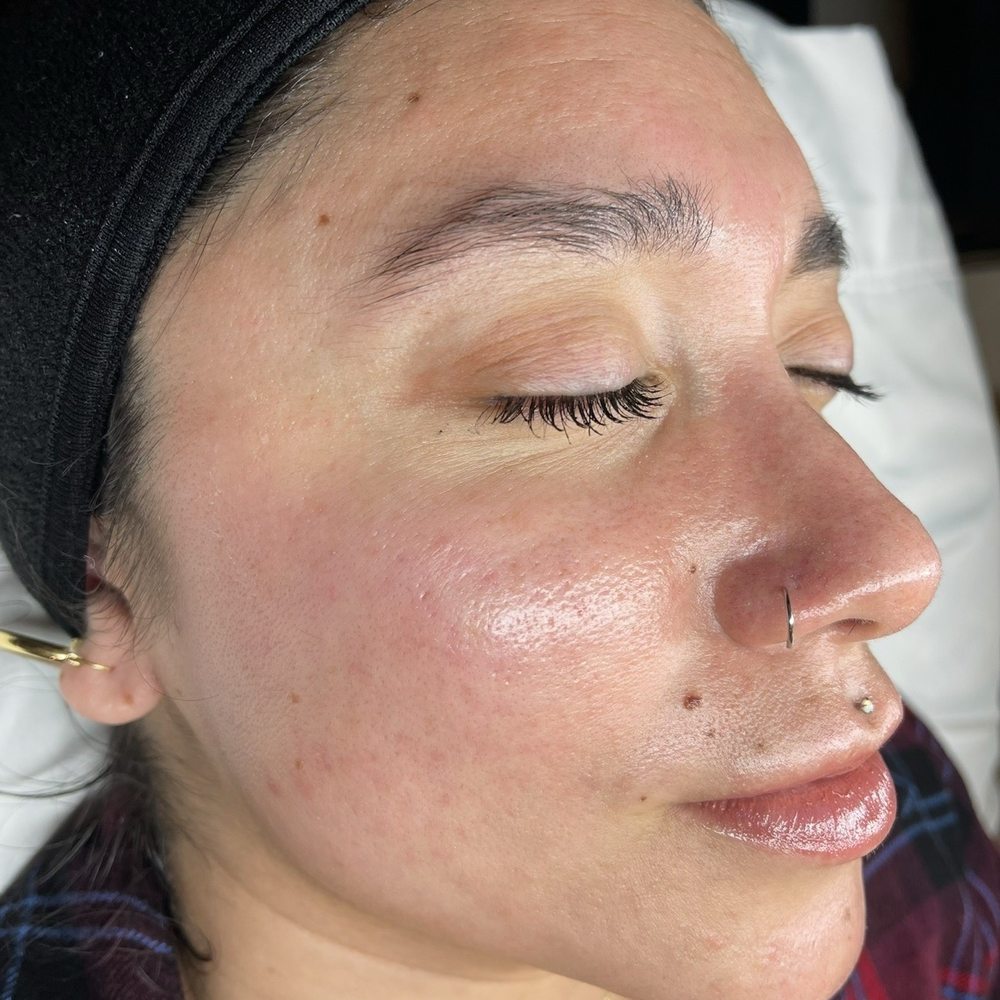 SALT Esthetics + Wellness - after facial - Estheticians Near Me - Riverside, California
