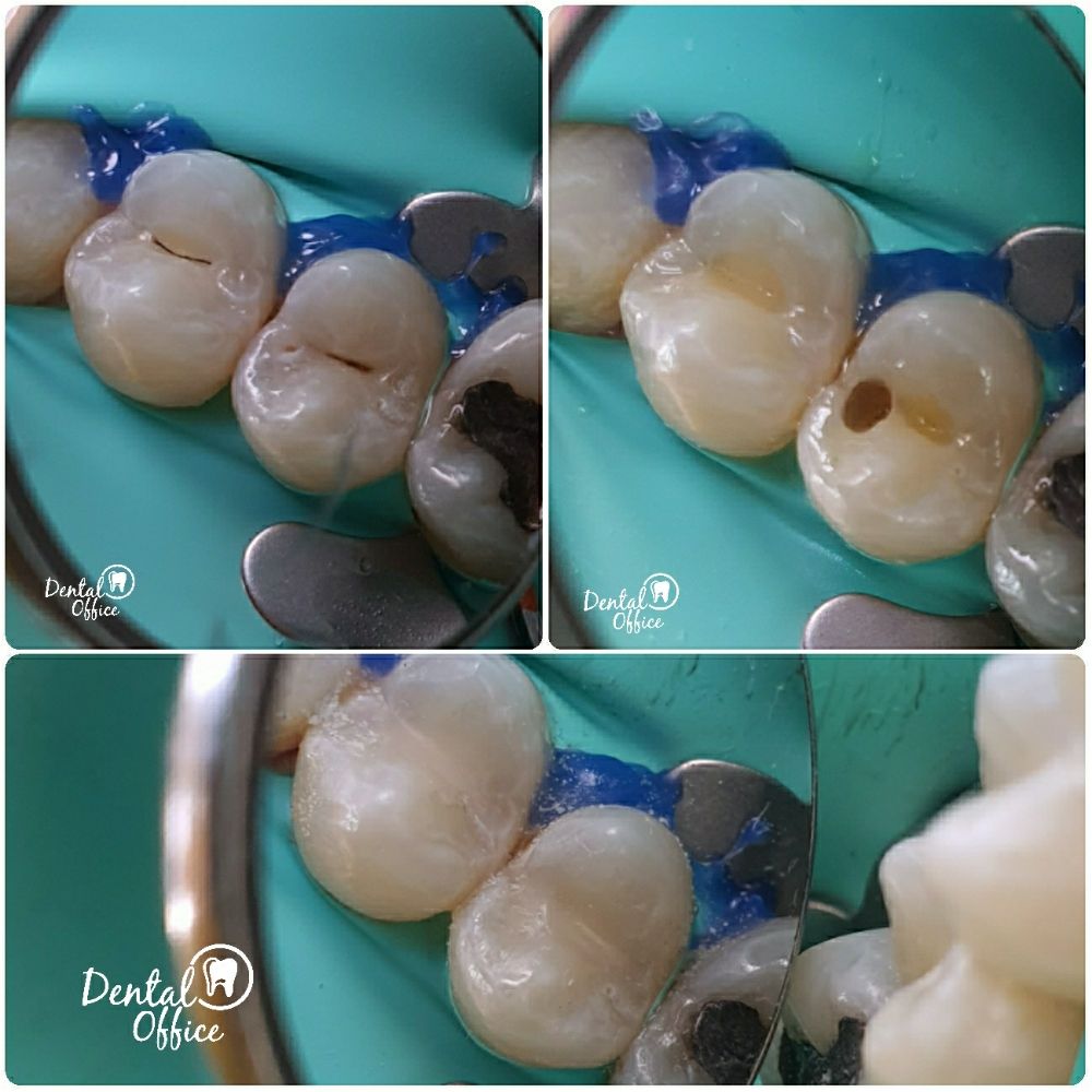 DENTIFUL /DENTAL OFFICE 31 Photos Av. López Mateos 92526, Ensenada