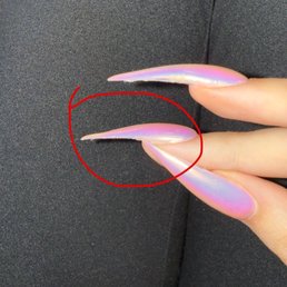 The fill was awful.