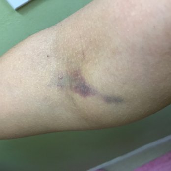 Quest Diagnostics - After 3 days - Laboratory Testing Near Me - Anaheim, California Quest Diagnostics - After 3 days - Laboratory Testing Near Me - Anaheim, California