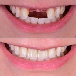 Dr. Michael Y. Jacobson - Robertson Dental Group