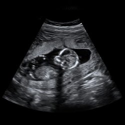 White Stork & Co - Want to know if your having a boy or a girl? We can tell as early as 14 weeks and we even do gender reveal photo shoots to celebrate!
