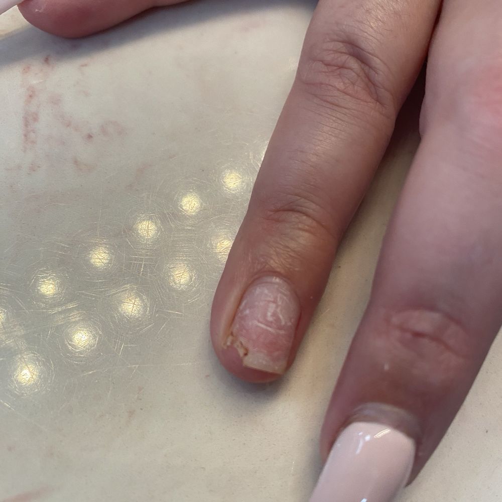 Nicholas Nails II - Broken and brittle nails after seeing Tony for mani - Nail Salons Near Me - Spring Hill, Florida Nicholas Nails II - Broken and brittle nails after seeing Tony for mani - Nail Salons Near Me - Spring Hill, Florida