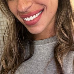 Cal Dental - My new smile