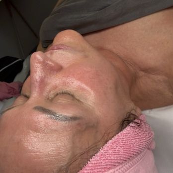 Flaunt It Esthetics - After glo and you can see it!! - Estheticians Near Me - Overland Park, Kansas