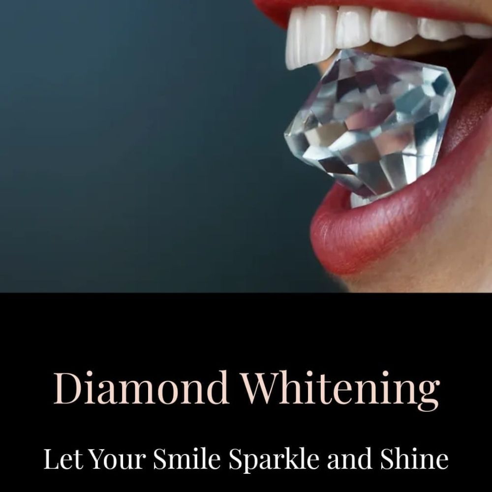 DIAMOND WHITENING Request an Appointment Zionsville, Indiana Teeth Whitening Phone