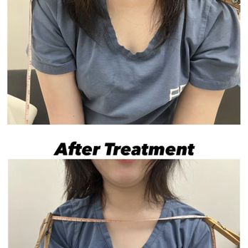 AC Acupuncture - Acupuncture Near Me - Rosemead, California AC Acupuncture - Acupuncture Near Me - Rosemead, California