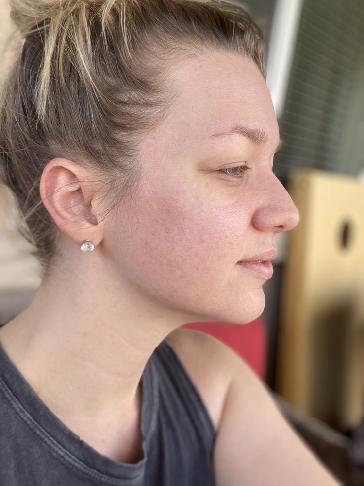 Liberation Acne Clinic Logo