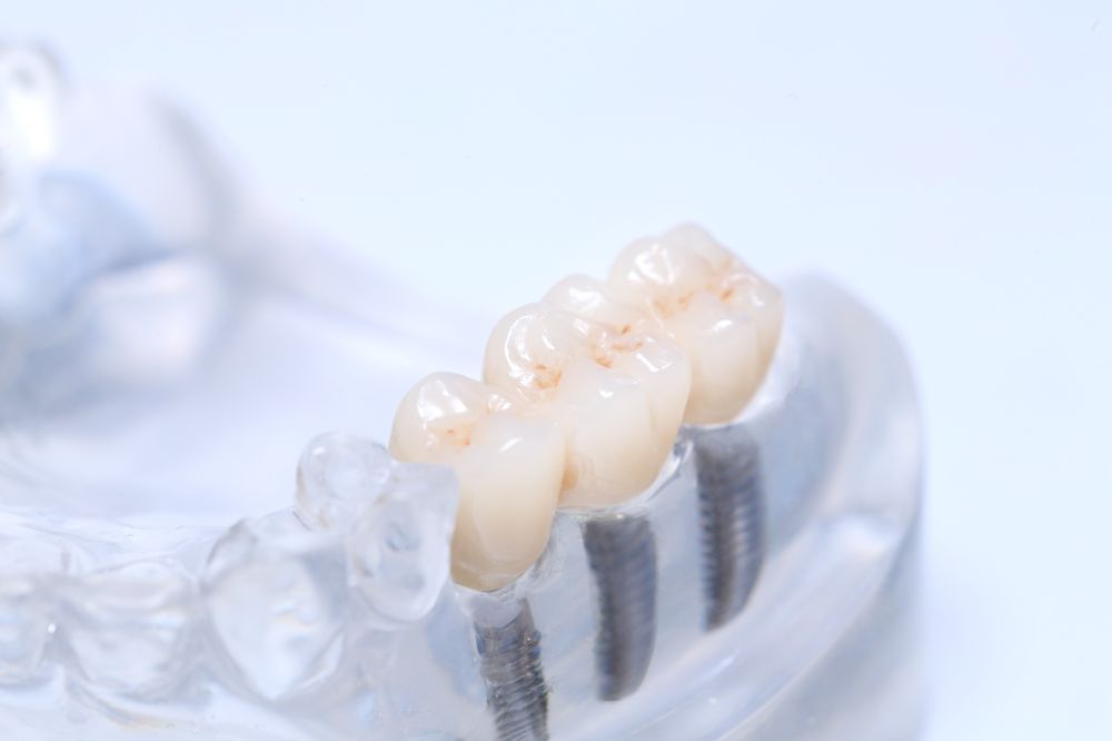 RESILIENT SMILE DENTAL LAB Updated August 2024 21220 Devonshire St