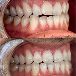 Serene Smiles Dental