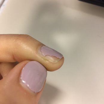 Royal Nails Studio - Middle finger chipped after 8 days - Nail Salons Near Me - Los Angeles, California Royal Nails Studio - Middle finger chipped after 8 days - Nail Salons Near Me - Los Angeles, California