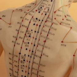 Juno Wellness Acupuncture