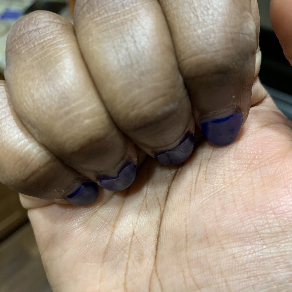 Classy Nails - Not even two weeks old. Started lifting after 5 days - Nail Salons Near Me - Newburgh, New York