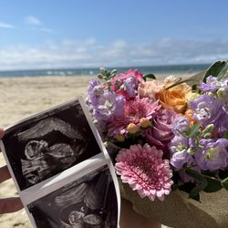 Next Generation Prenatal Imaging - Our ultrasound pictures of our little princess