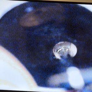 ENT ASSOCIATES OF MANATEE - Updated January 2025 - 8340 Lakewood Ranch