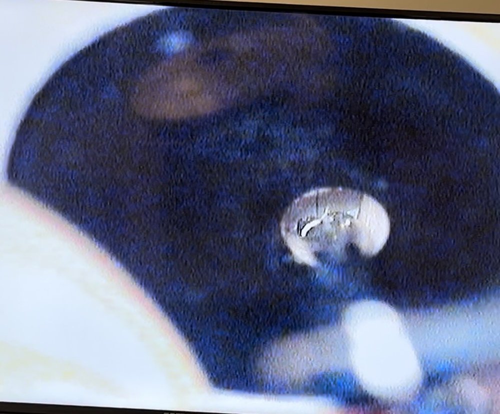 ENT ASSOCIATES OF MANATEE - Updated December 2024 - 15 Reviews - 701