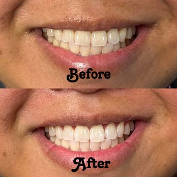 Retro Smile - Teeth Whitening Near Me - San Diego, California Retro Smile - Teeth Whitening Near Me - San Diego, California