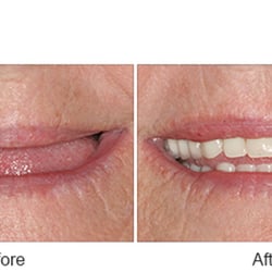 Gentle Dental - Wading River - A Dental365 Company